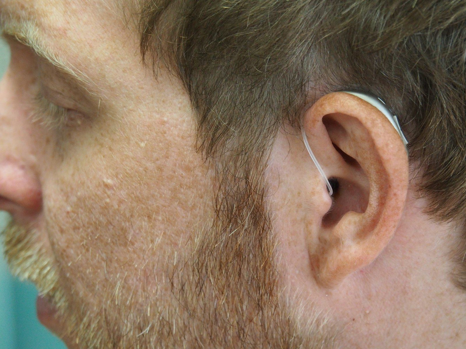 A man's ear with a hearing aid shown in profile